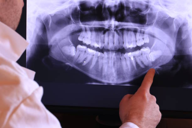 Best Broken or Cracked Tooth Emergency Dentist in New London, CT