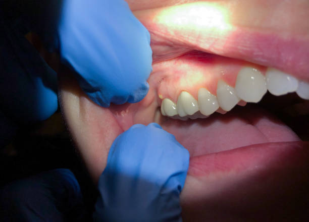 Best Emergency Dentist for Special Needs Patients in New London, CT